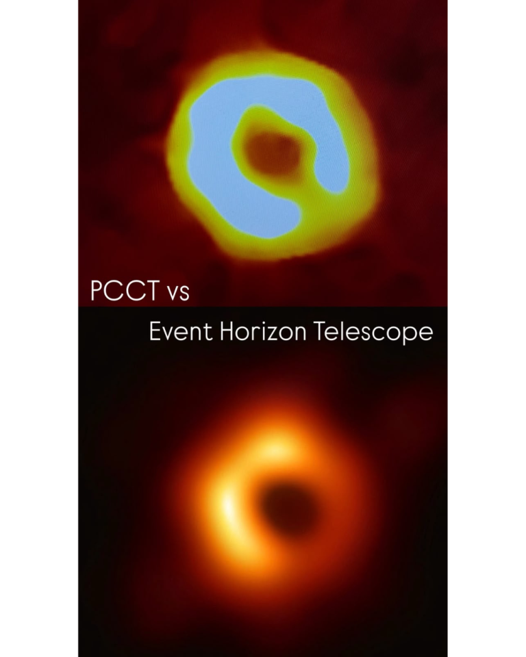 La Photon Counting CT sta ridefinendo i confini della diagnostica per immagini.